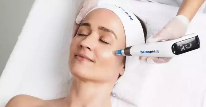 MICRO-NEEDLING (DERMAPEN TREATMENT)